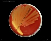listeria on blood agar